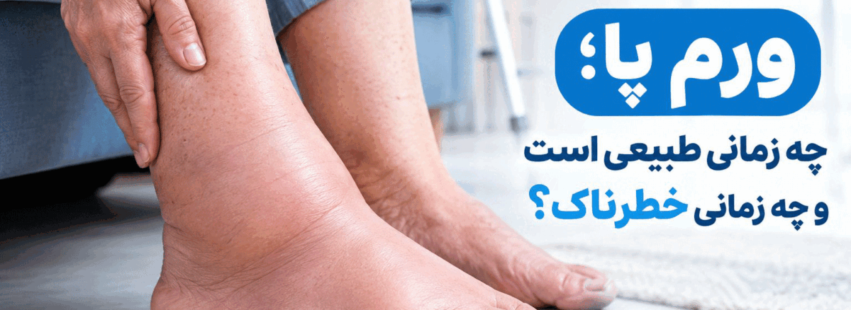 ورم پا چه زمانی خطرناک است ؟