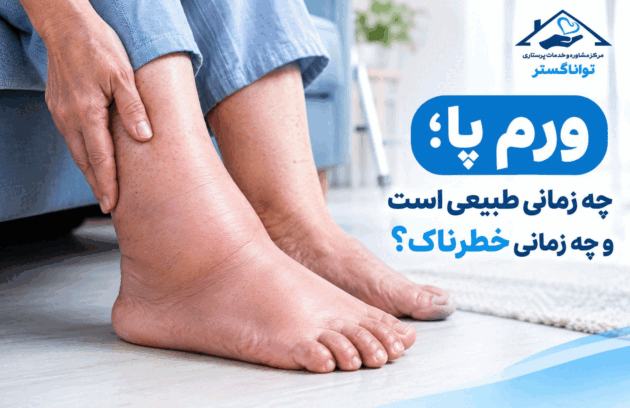 ورم پا چه زمانی خطرناک است ؟